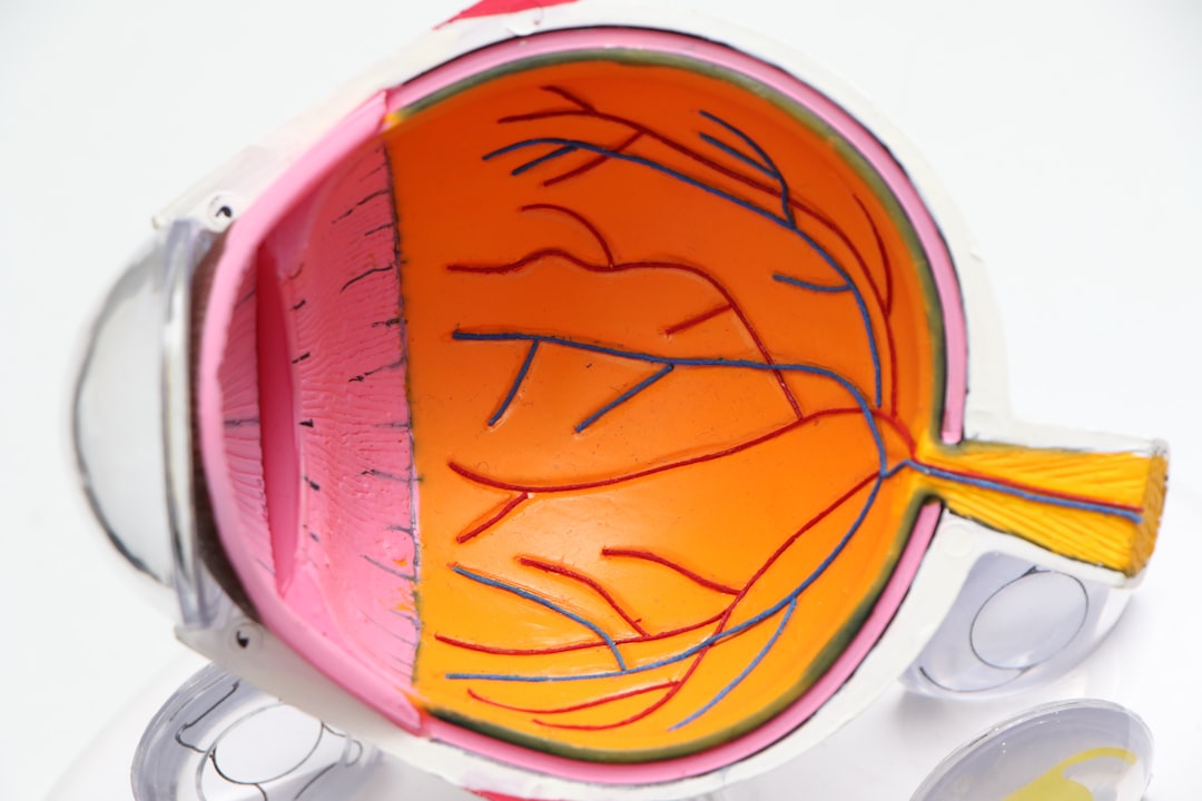 From Cataract Surgery to YAG Capsulotomy: A Surgeon’s Own Journey Through Vision Restoration